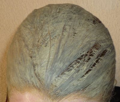 Cataplasme ail repousse cheveux